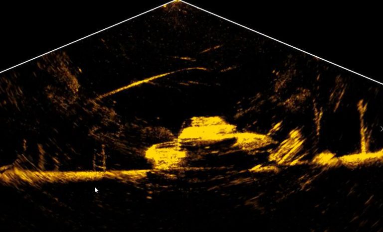 What Have YOU Found with ActiveTarget?